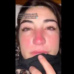 bloqueador solar natural